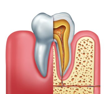 Teeth and roots